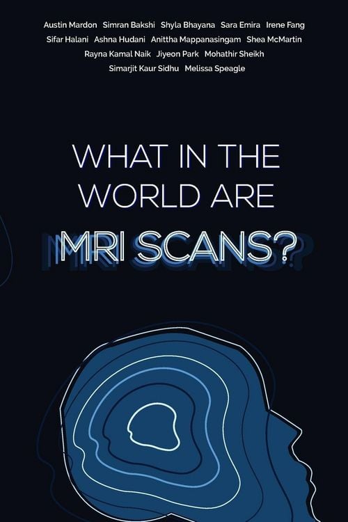 Produktbild: What in the world are MRI Scans?