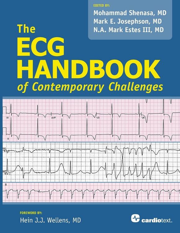 Produktbild: ECG Handbook of Contemporary Challenges