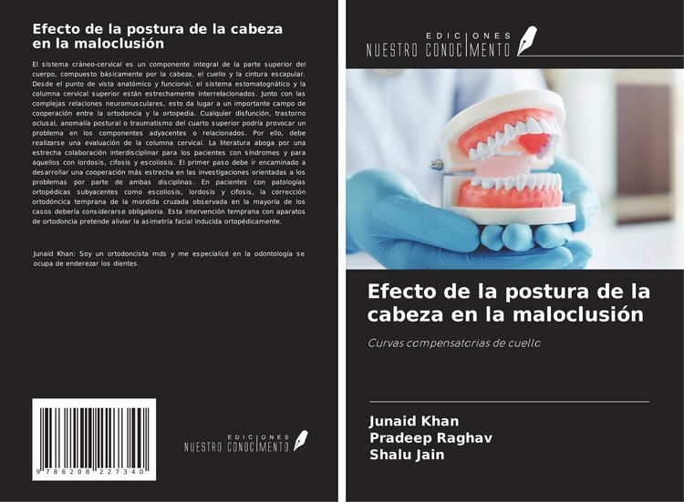 Produktbild: Efecto de la postura de la cabeza en la maloclusi&oacute;n