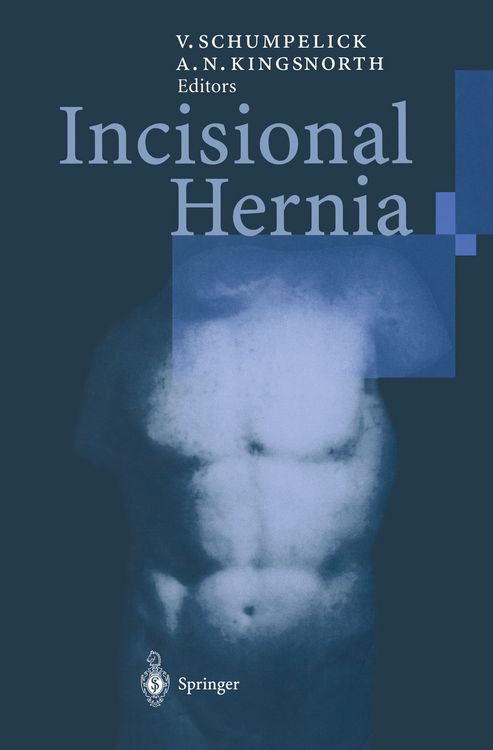 Produktbild: Incisional Hernia