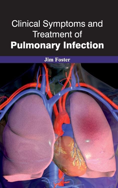 Produktbild: Clinical Symptoms and Treatment of Pulmonary Infection