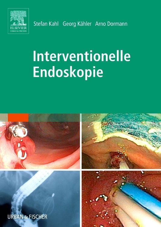 Produktbild: Interventionelle Endoskopie