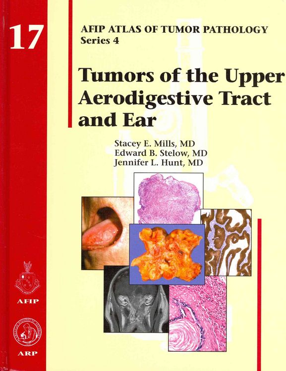 Produktbild: Mills, S: Tumors of the Upper Aerodigestive Tract and Ear