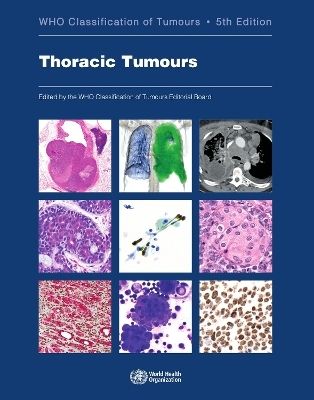 Produktbild: Thoracic Tumours