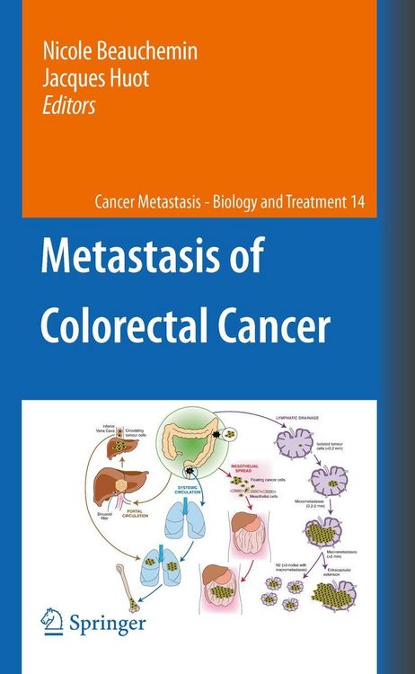 Produktbild: Metastasis of Colorectal Cancer