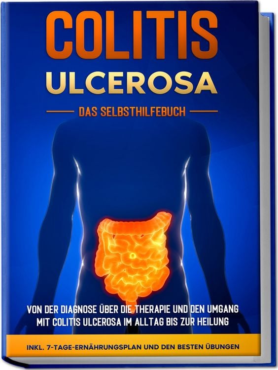 Produktbild: Colitis ulcerosa - Das Selbsthilfebuch: Von der Diagnose &uuml;ber die Therapie und d