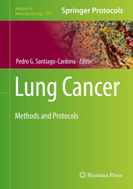Produktbild: Lung Cancer