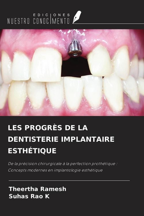 Produktbild: Les Progr&egrave;s De La Dentisterie Implantaire Esth&eacute;tique