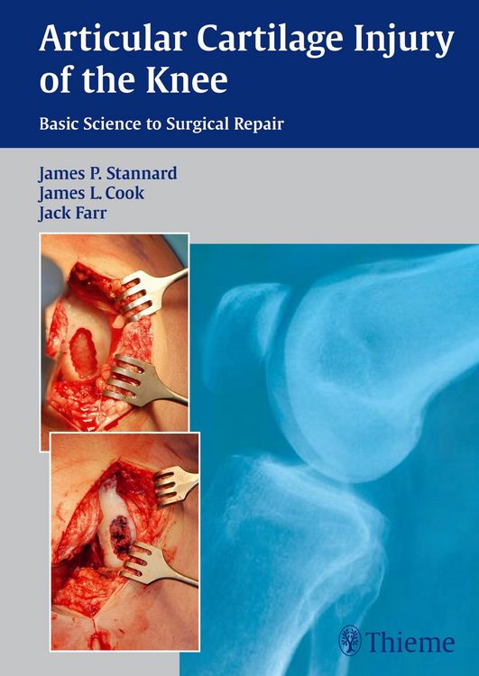 Produktbild: Articular Cartilage Injury of the Knee: Basic Science to Surgical Repair