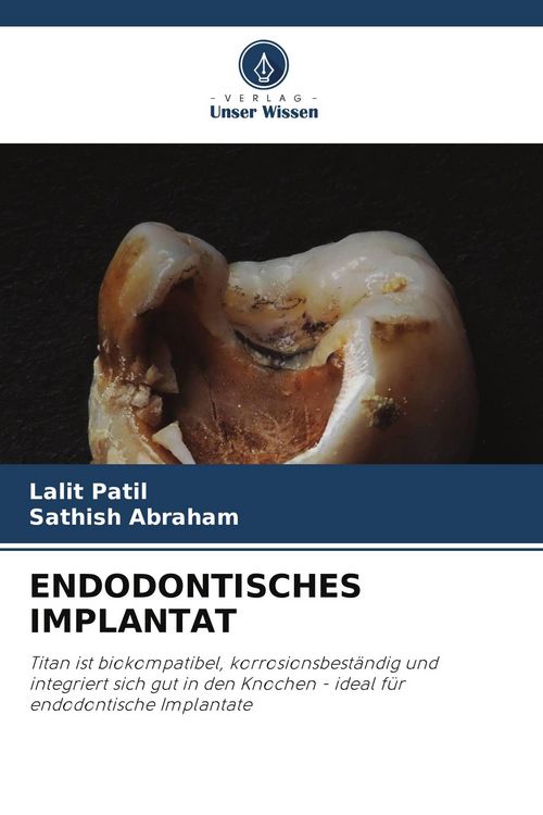 Produktbild: Endodontisches Implantat