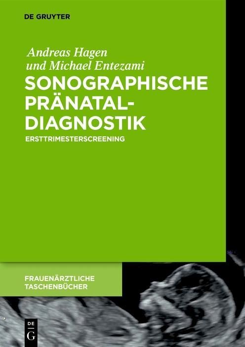 Produktbild: Sonographische Pr&auml;nataldiagnostik