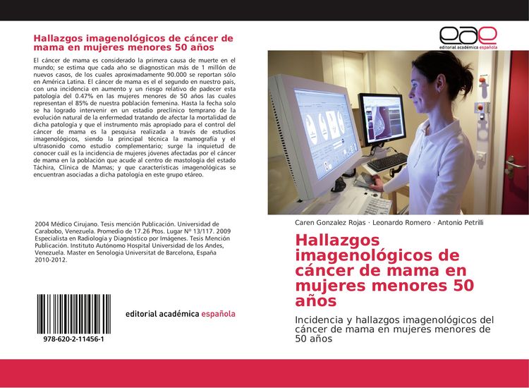 Produktbild: Hallazgos imagenol&oacute;gicos de c&aacute;ncer de mama en mujeres menores 50 a&ntilde;os