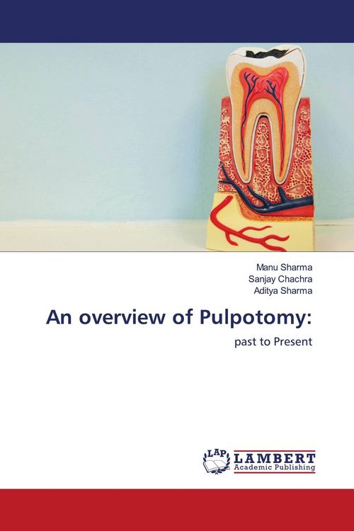 Produktbild: An overview of Pulpotomy: