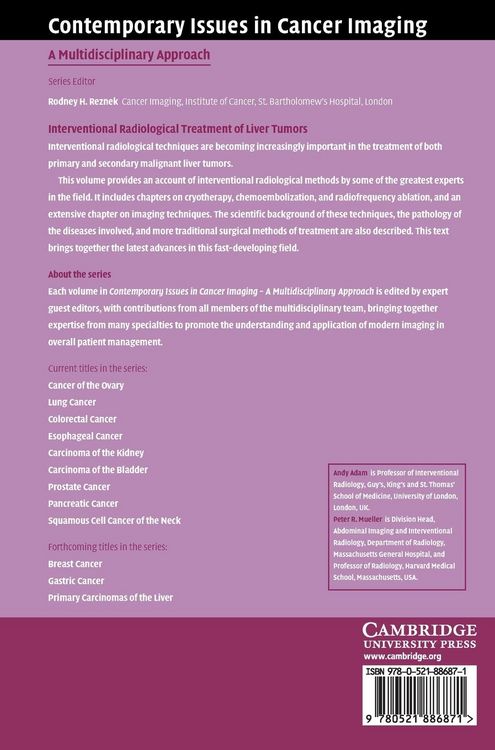 Produktbild: Interventional Radiological Treatment of Liver Tumors