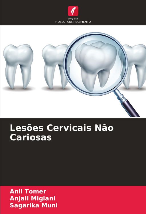Produktbild: Les&otilde;es Cervicais N&atilde;o Cariosas