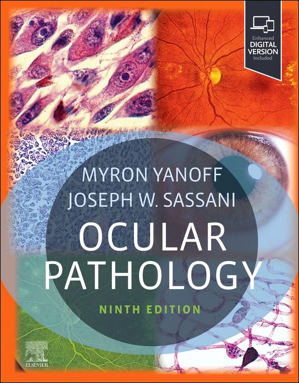 Produktbild: Ocular Pathology