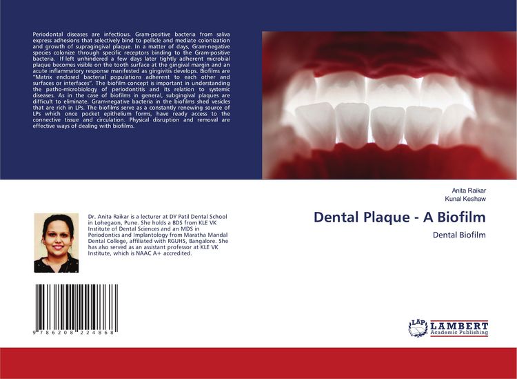 Produktbild: Dental Plaque - A Biofilm