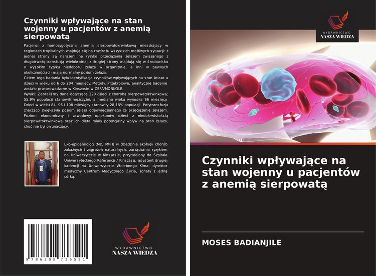 Produktbild: Czynniki wp&iquest;ywaj&iquest;ce na stan wojenny u pacjent&oacute;w z anemi&iquest; sierpowat&iquest;