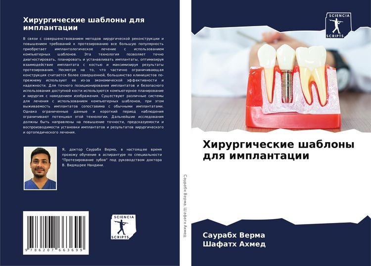 Produktbild: Hirurgicheskie shablony dlq implantacii