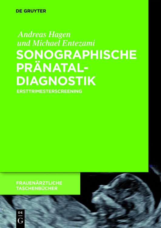 Produktbild: Sonographische Pr&auml;nataldiagnostik