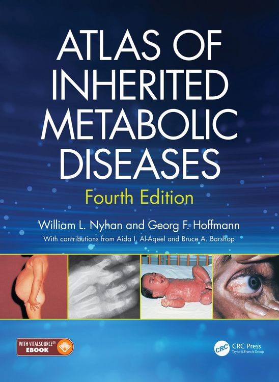 Produktbild: Atlas of Inherited Metabolic Diseases