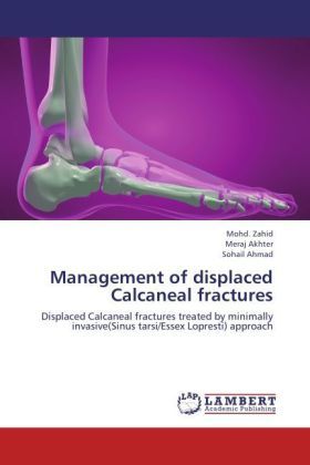 Produktbild: Zahid, M: Management of displaced Calcaneal fractures