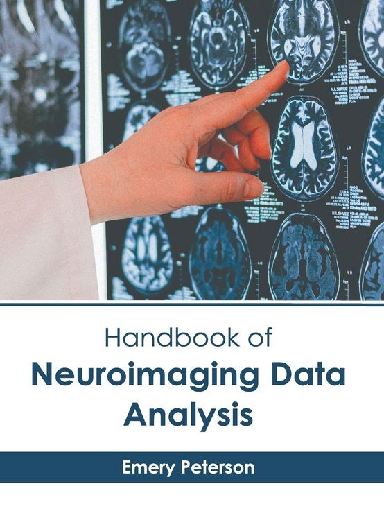 Produktbild: Handbook of Neuroimaging Data Analysis