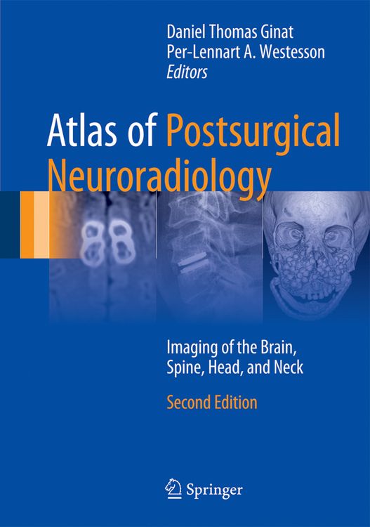 Produktbild: Atlas of Postsurgical Neuroradiology