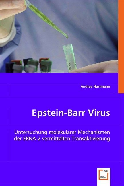 Produktbild: Hartmann, A: Epstein-Barr Virus