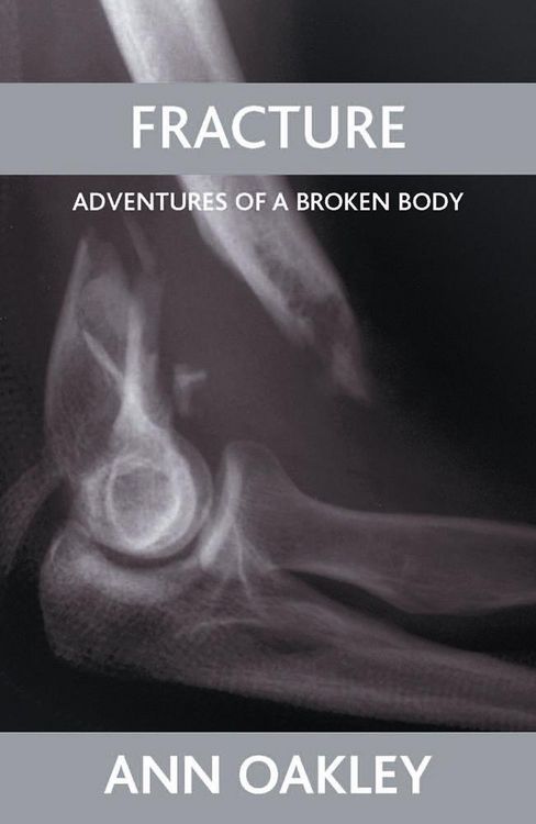 Produktbild: Fracture