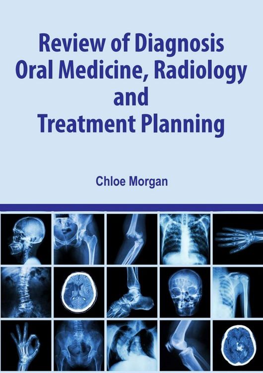 Produktbild: Review of Diagnosis, Oral Medicine, Radiology, and Treatment Planning