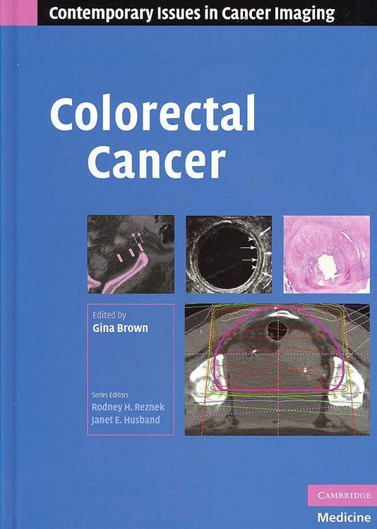 Produktbild: Colorectal Cancer