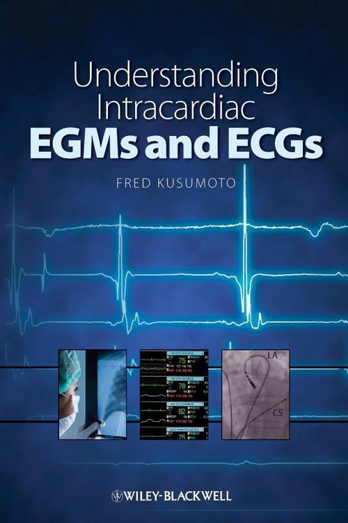 Produktbild: Understanding Intracardiac EGMs and ECGs