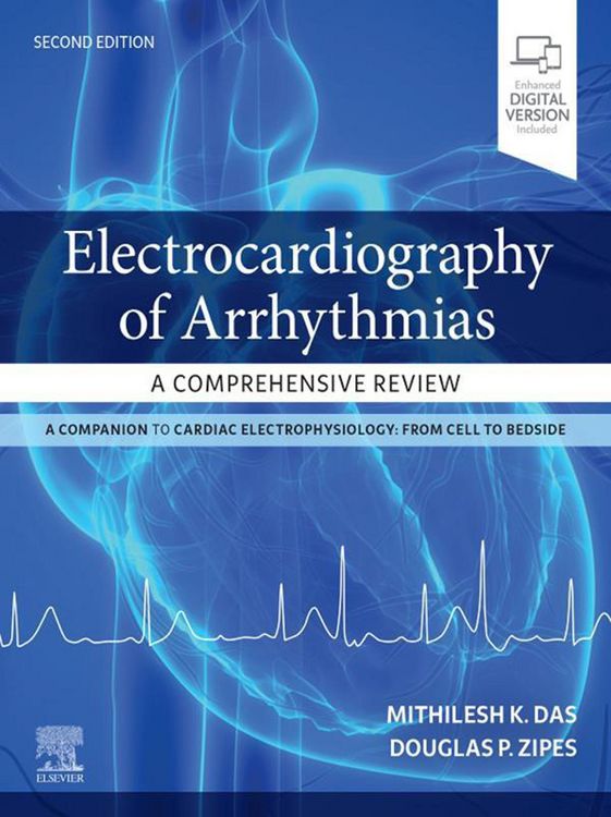 Produktbild: Electrocardiography of Arrhythmias: A Comprehensive Review E-Book