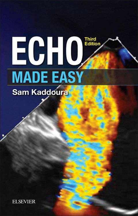Produktbild: Echo Made Easy E-Book