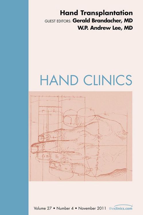 Produktbild: Hand Transplantation, An Issue of Hand Clinics