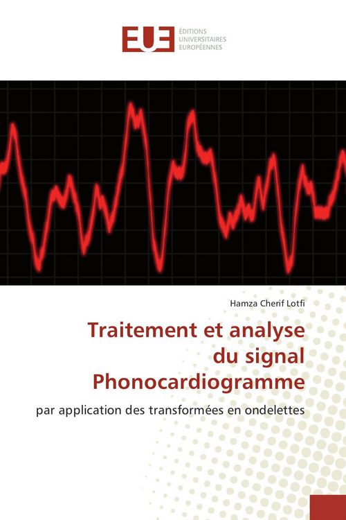 Produktbild: Traitement et analyse du signal Phonocardiogramme