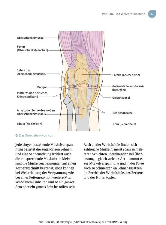 Produktbild: Fibromyalgie