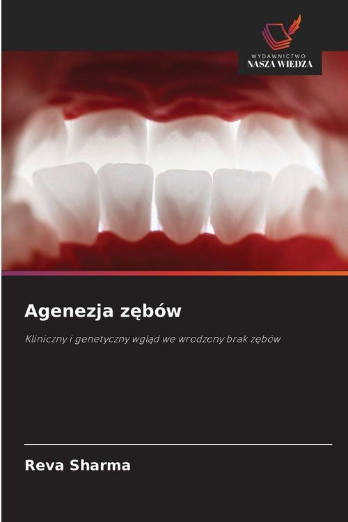 Produktbild: Agenezja zęb&oacute;w