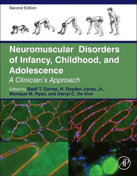 Produktbild: Neuromuscular Disorders of Infancy, Childhood, and Adolescence