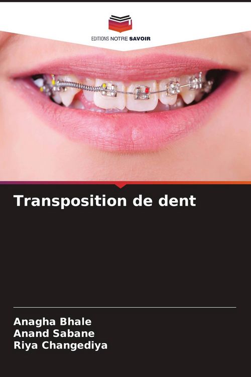 Produktbild: Transposition de dent