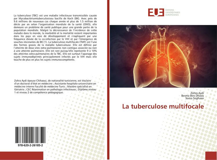 Produktbild: La tuberculose multifocale