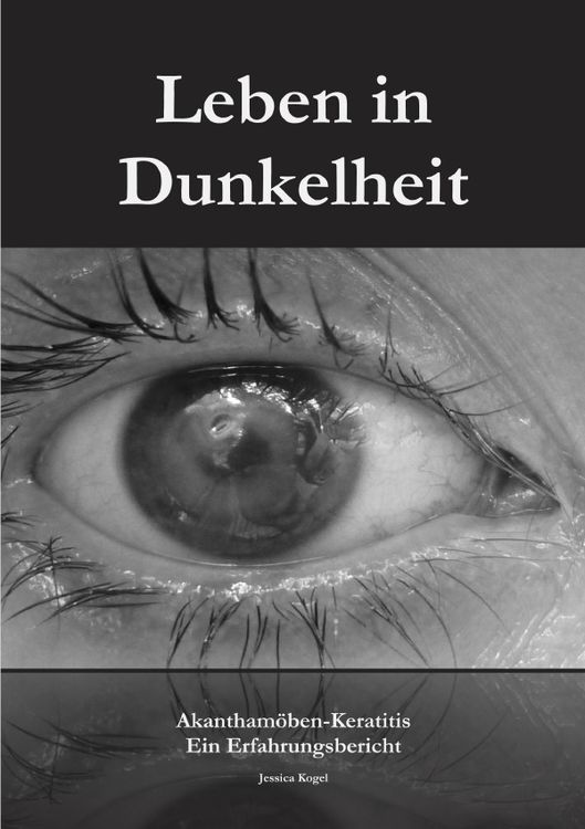 Produktbild: Leben in Dunkelheit - Akantham&ouml;ben-Keratitis