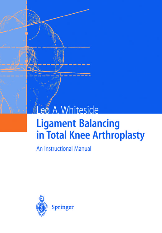Produktbild: Ligament Balancing in Total Knee Arthroplasty