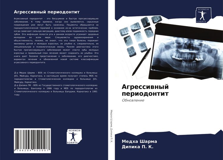 Produktbild: Agressiwnyj periodontit
