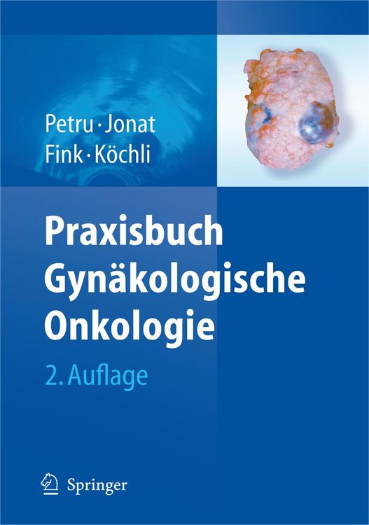 Produktbild: Praxisbuch Gyn&auml;kologische Onkologie