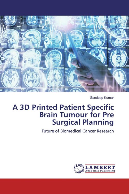 Produktbild: A 3D Printed Patient Specific Brain Tumour for Pre Surgical Planning