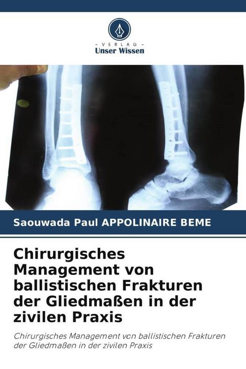Produktbild: Chirurgisches Management von ballistischen Frakturen der Gliedma&szlig;en in der zivilen Praxis