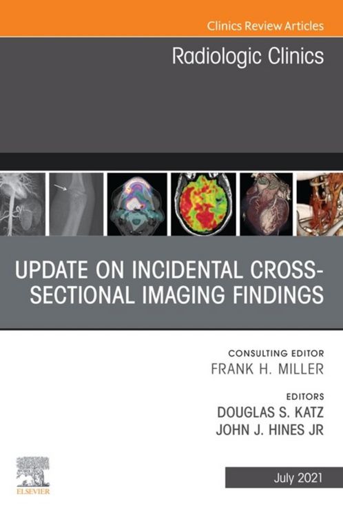 Produktbild: Update on Incidental Cross-sectional Imaging Findings, An Issue of Radiologic Clinics of North America, EBook