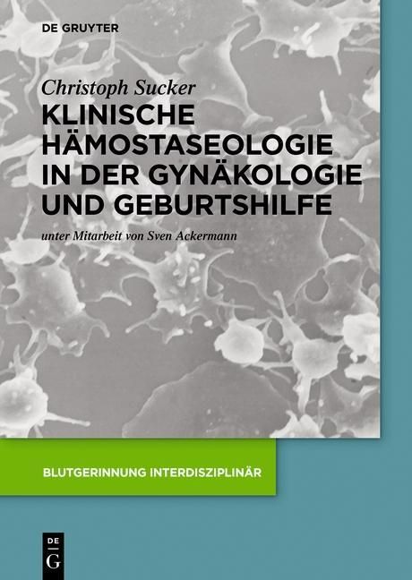 Produktbild: Klinische H&auml;mostaseologie in der Gyn&auml;kologie und Geburtshilfe